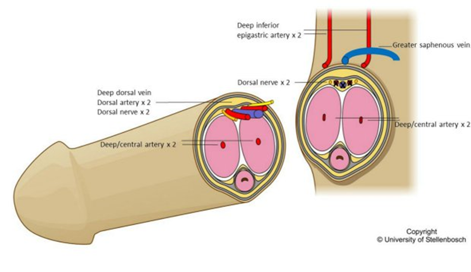 penis transplant